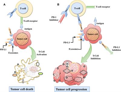 ExoPD-L1: an assistant for tumor progression and potential diagnostic marker